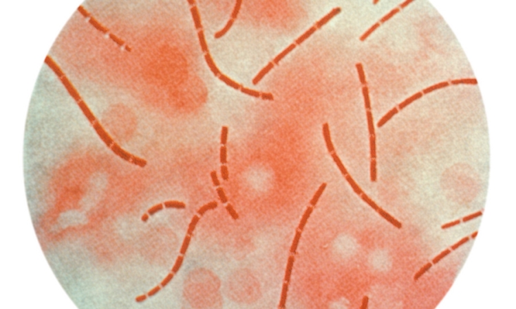 A photomicrographic view of Bacillus anthracis bacteria taken from heart blood and processed using a carbol-fuchsin stain. (Image Courtesy: Centers for Disease Control and Prevention)